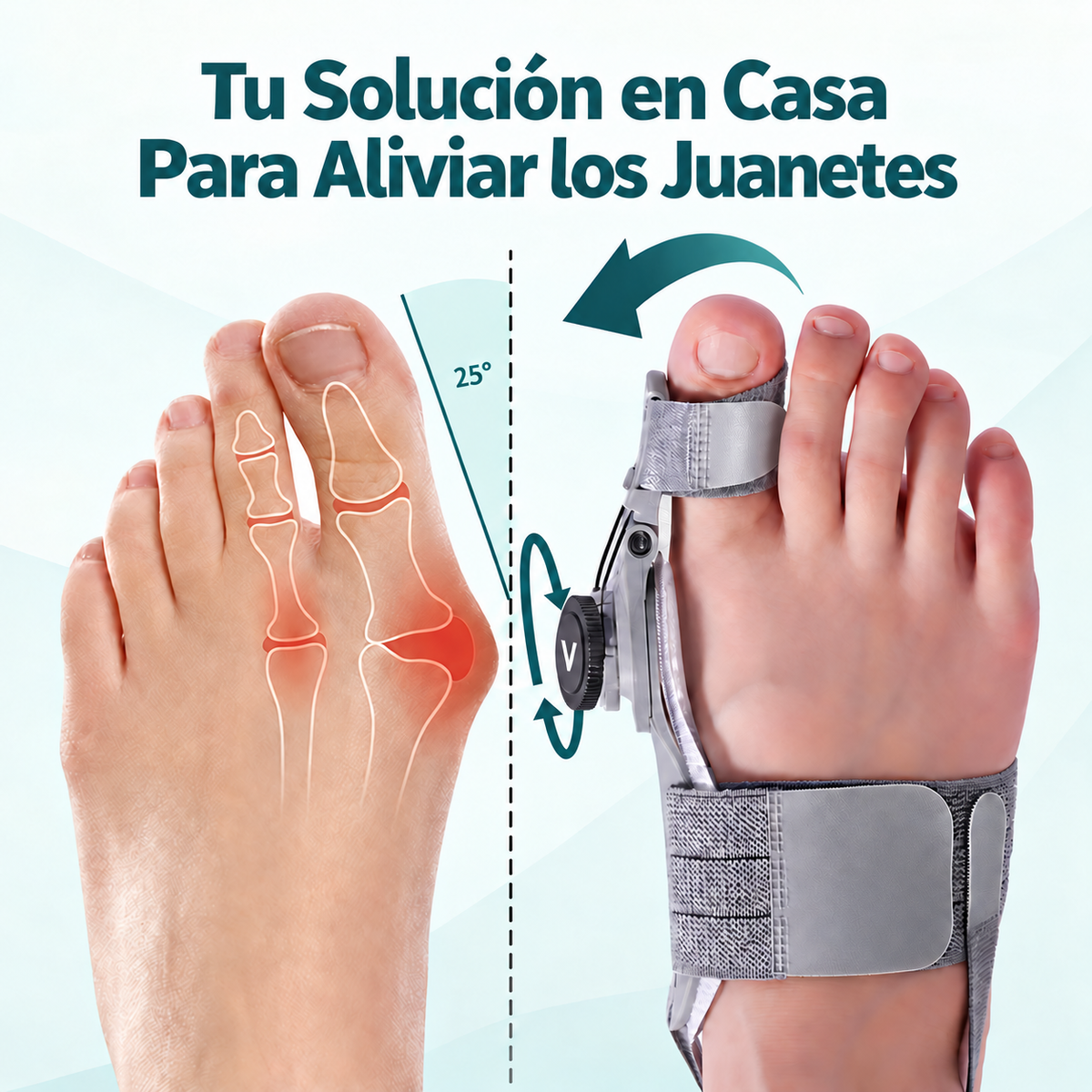 VELORA Corrector de Juanetes - solución en casa